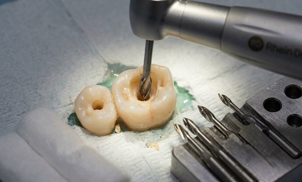 Gates Glidden drill used for coronal flaring during root canal preparation